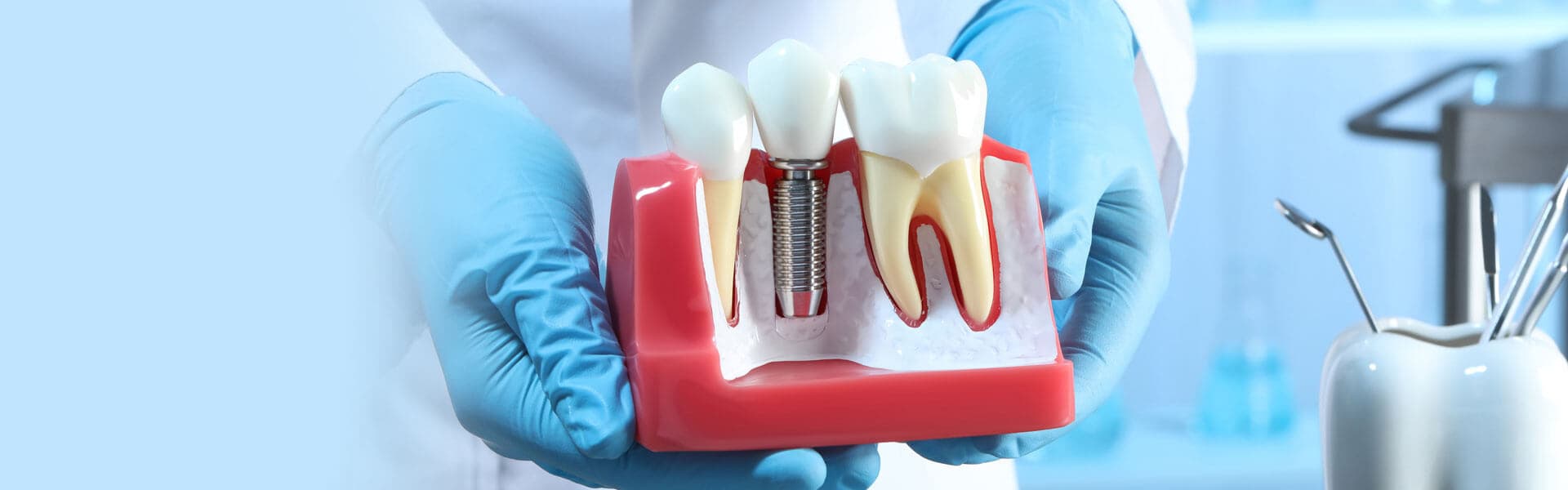 Can Dental Implants Affect Your Eyes?