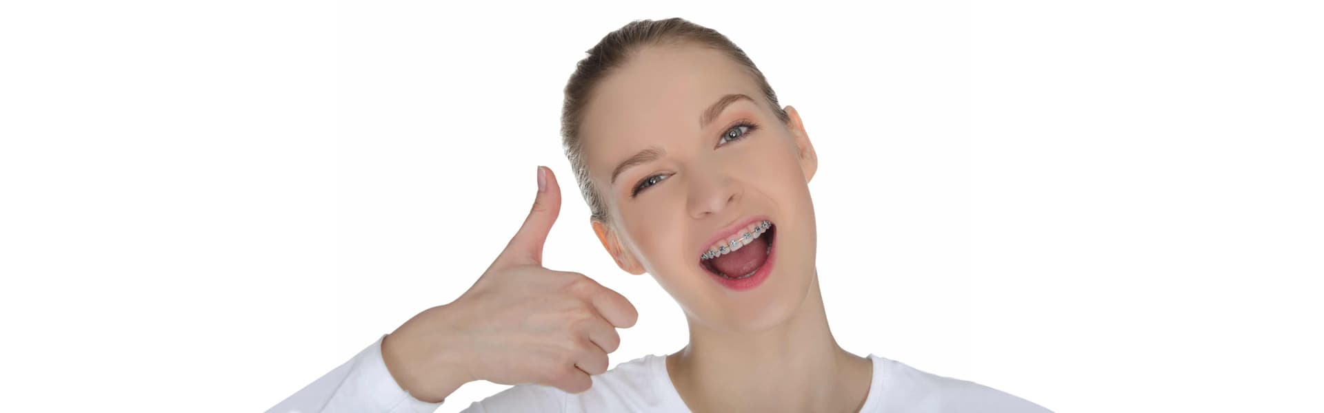 Which Type of Braces Would You Prefer for Straightening Your Teeth?