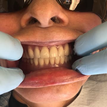 After smile transformation 02