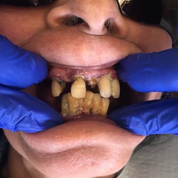 Before smile transformation 02